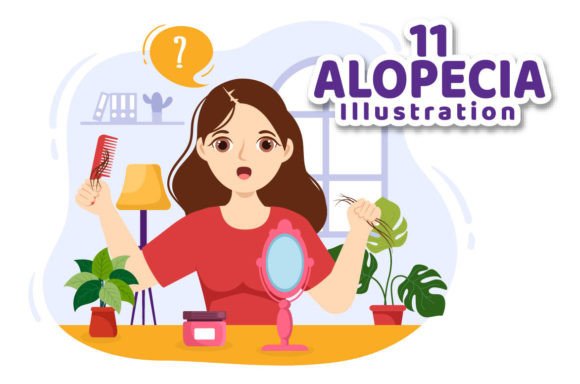 Download 11 Alopecia Hair Loss Illustration - Hair loss Collection
