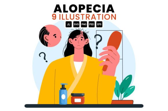 Download 9 Alopecia Hair Loss Illustration - Hair loss Collection
